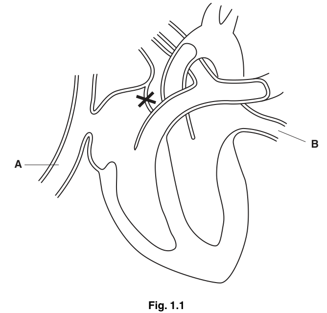Fig. 1.1