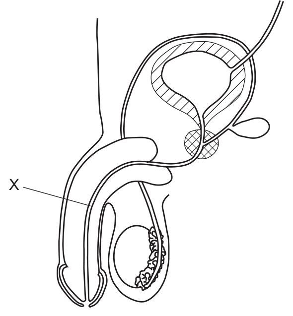 The diagram, as printed with the question.