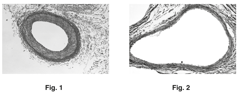 Fig. 1 and Fig. 2