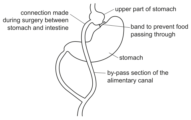 Fig. 1.2