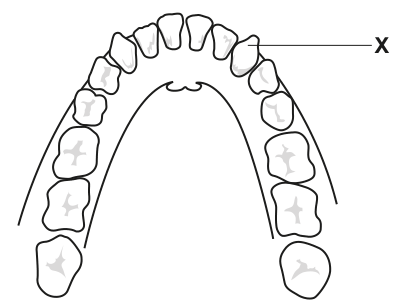 Fig. 1.1