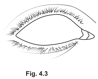 Fig. 4.3