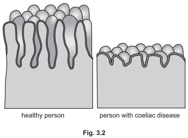 Fig. 3.2