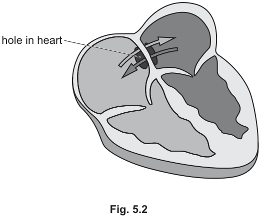 Fig. 5.2