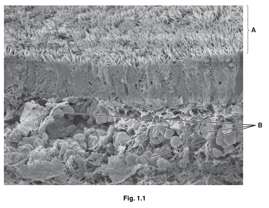 Fig. 1.1