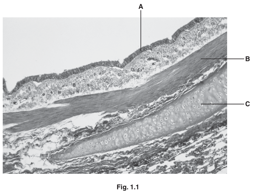 Fig. 1.1