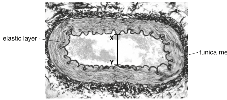Fig. 4.1 — cross-section of a human renal artery, with X–Y marked across the lumen, as printed with the question.