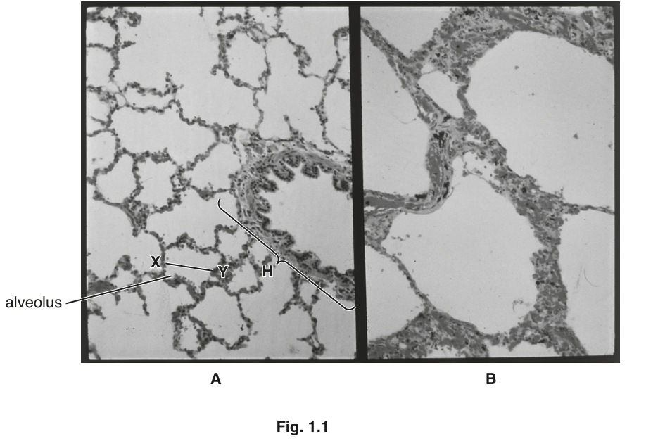 Fig. 1.1