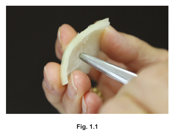 Fig. 1.1