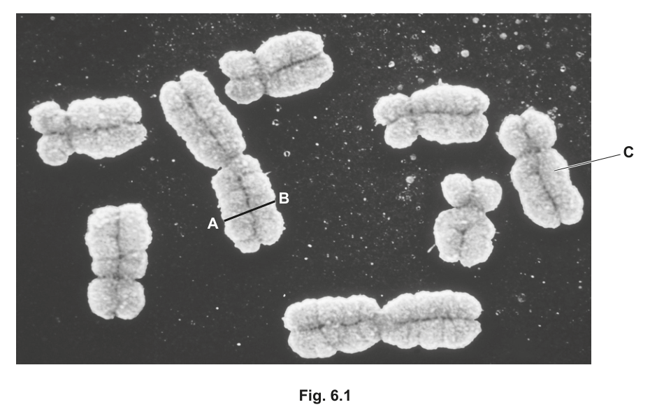 Fig. 6.1 — scanning electron micrograph of a group of human chromosomes at metaphase, with chromosome C and the line A–B labelled, as printed with the question.