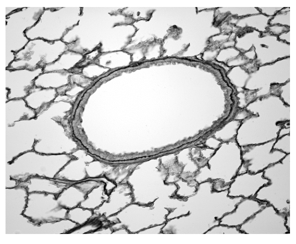 Fig. 1.1
