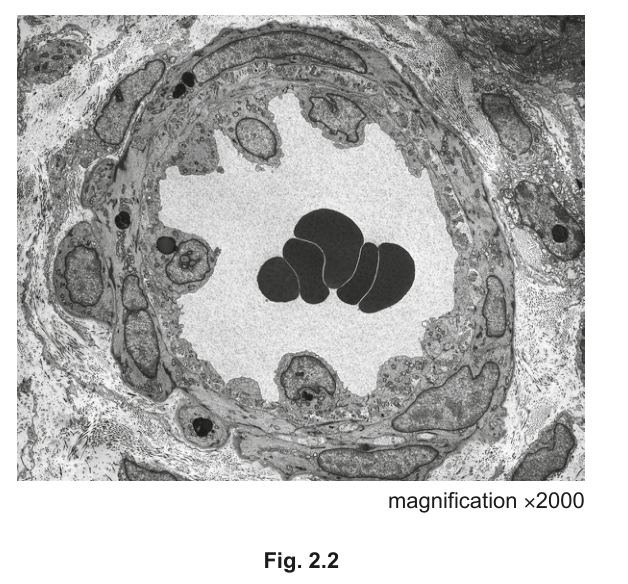 Fig. 2.2