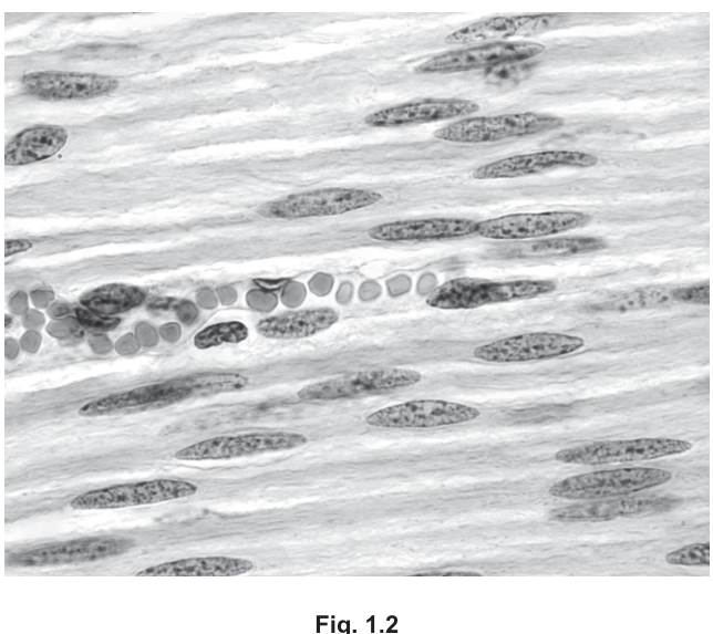 Fig. 1.2