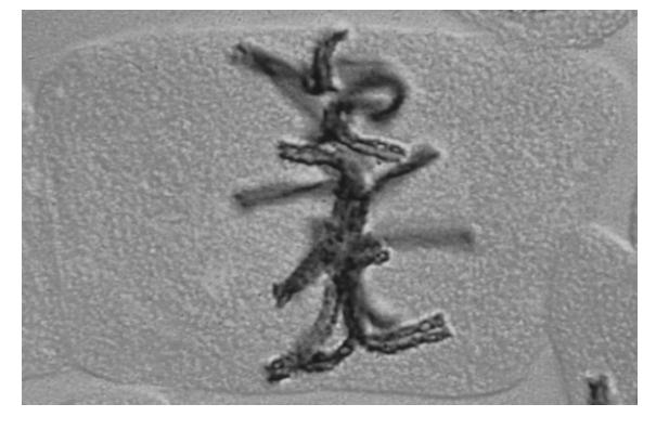 Mitosis Stage