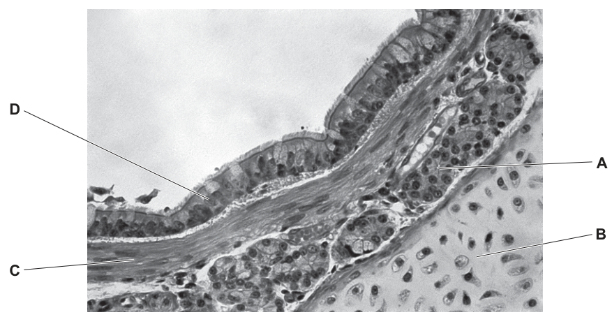 Bronchus Micrograph