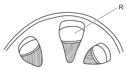 Fig. 26.1
