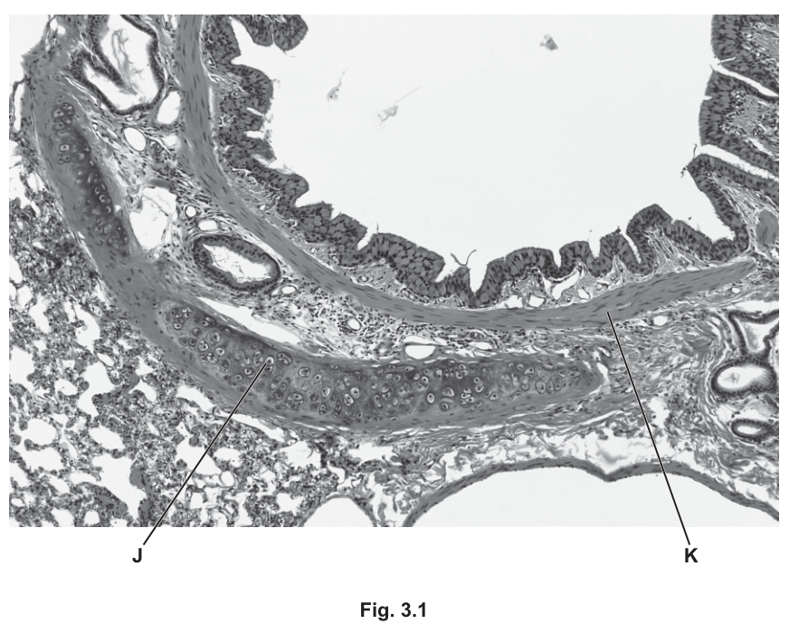 Fig. 3.1