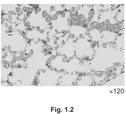 Fig. 1.2