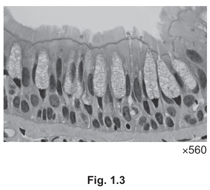 Fig. 1.3
