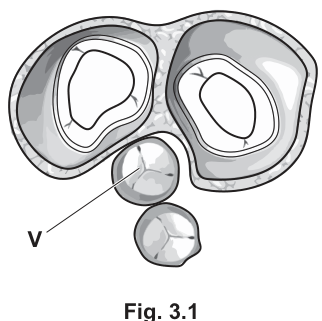 Fig. 3.1