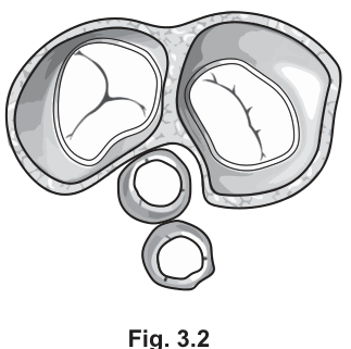 Fig. 3.2