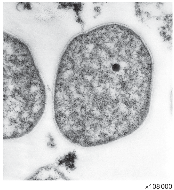 Fig. 3.1
