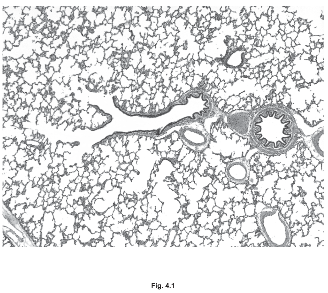 Fig. 4.1