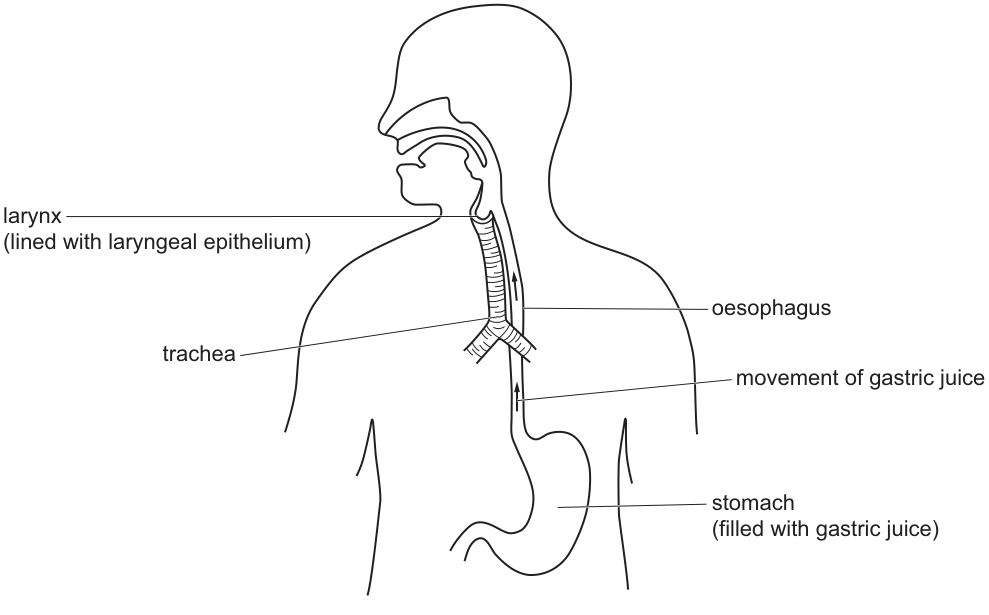 Fig. 1.4