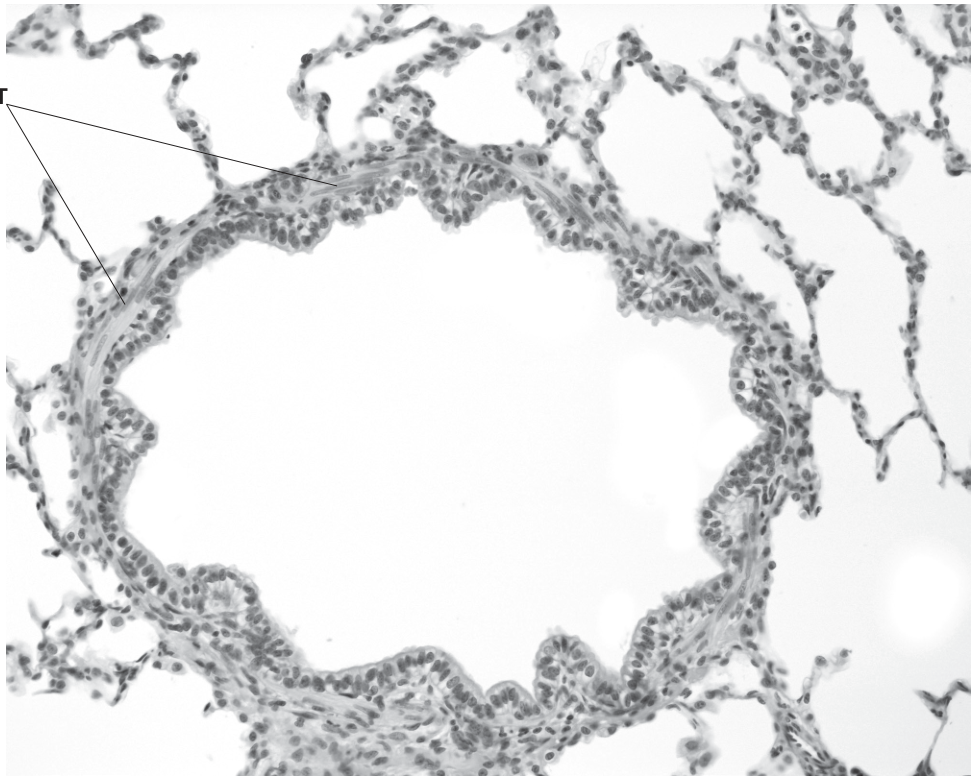 Fig. 4.1